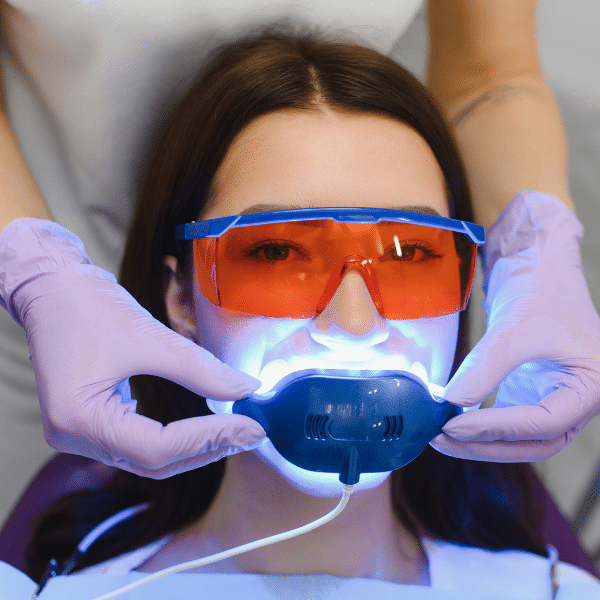 Tooth Whitening Options: In Office or Take Home